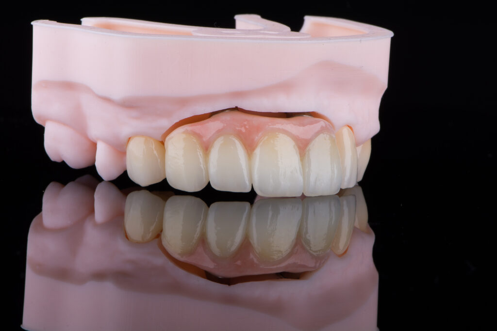 High-quality naturally dental single crowns made of zirconium for fixation to the frontal teeth of upper jaw.