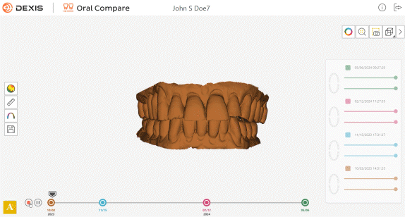 השוואת סריקות לאורך זמן