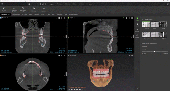 תכנון טיפול בתוך דקות